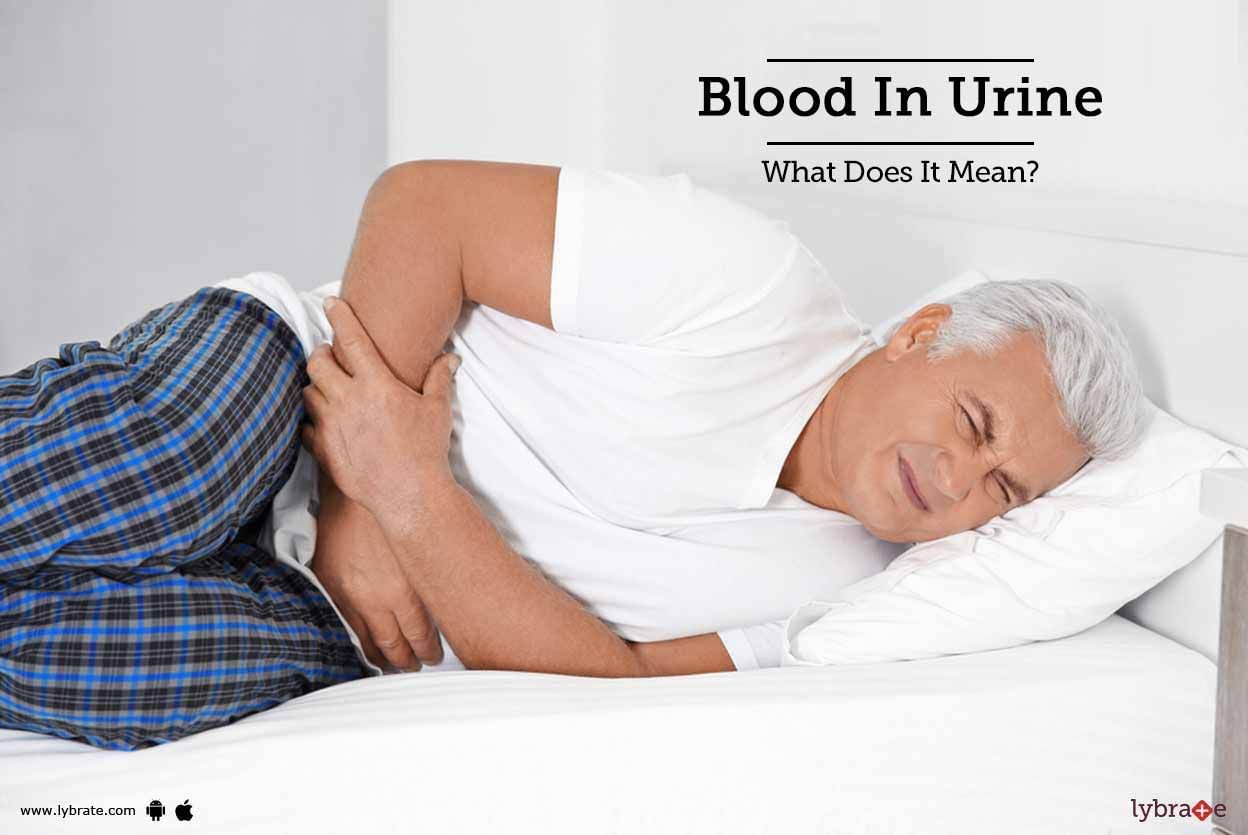 Blood In Urine - What Does It Mean?