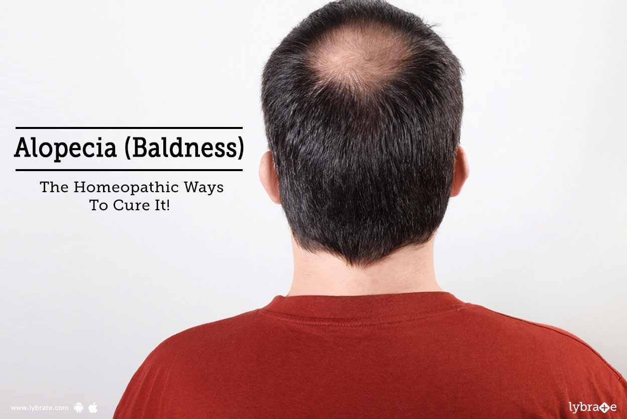 Alopecia (Baldness) - The Homeopathic Ways To Cure It!