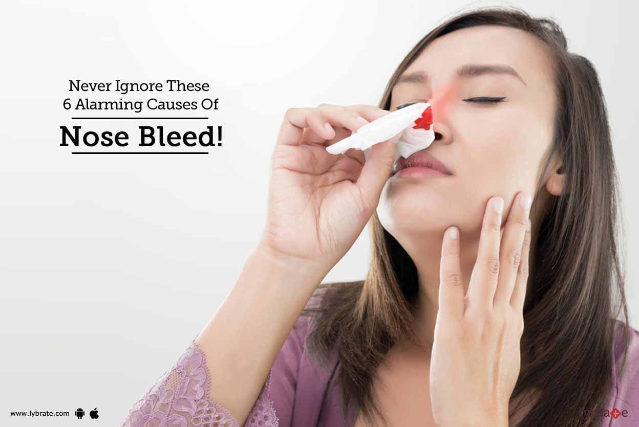 Never Ignore These 6 Alarming Causes Of Nose Bleed!