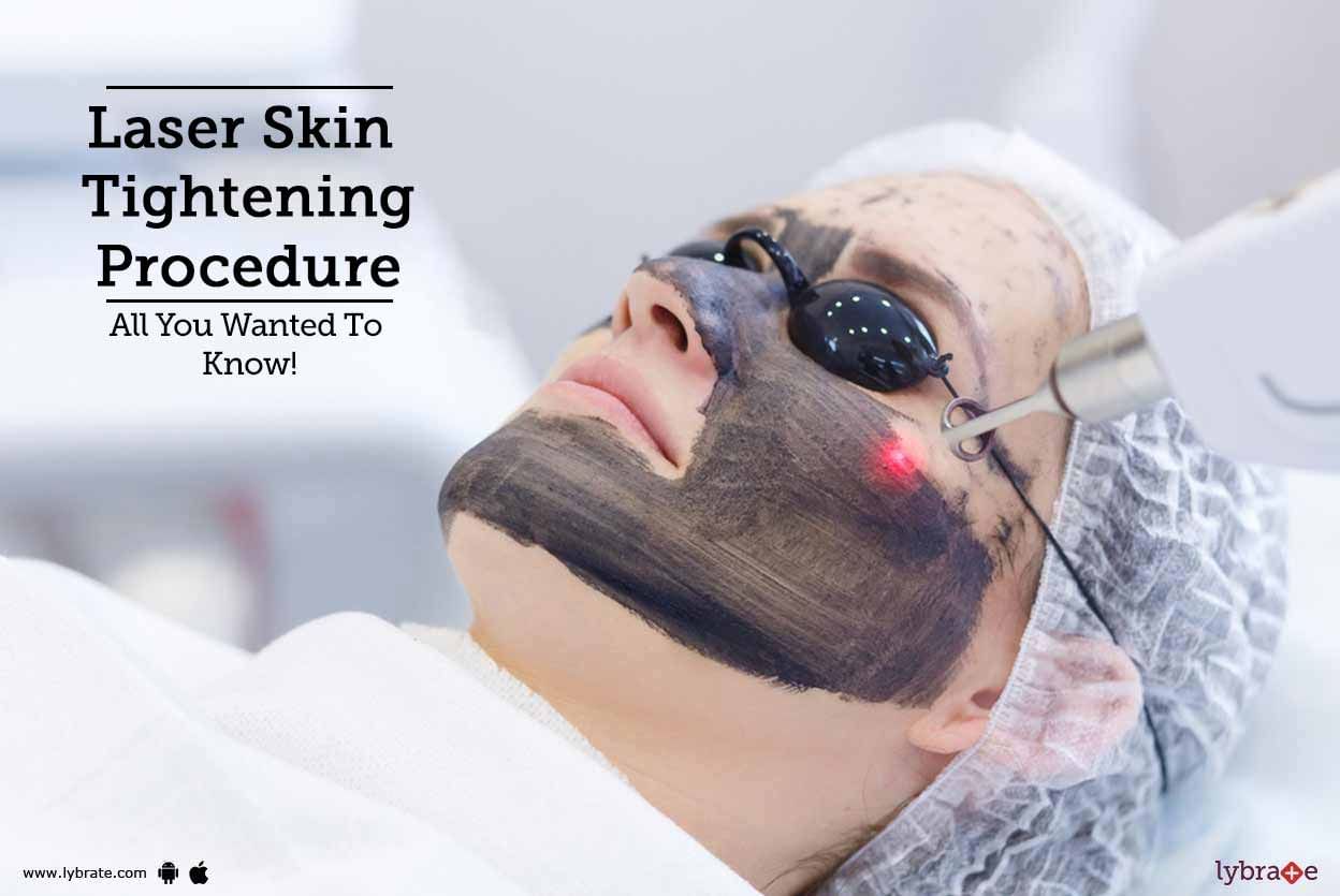 Laser Skin Tightening Procedure - All You Wanted To Know!