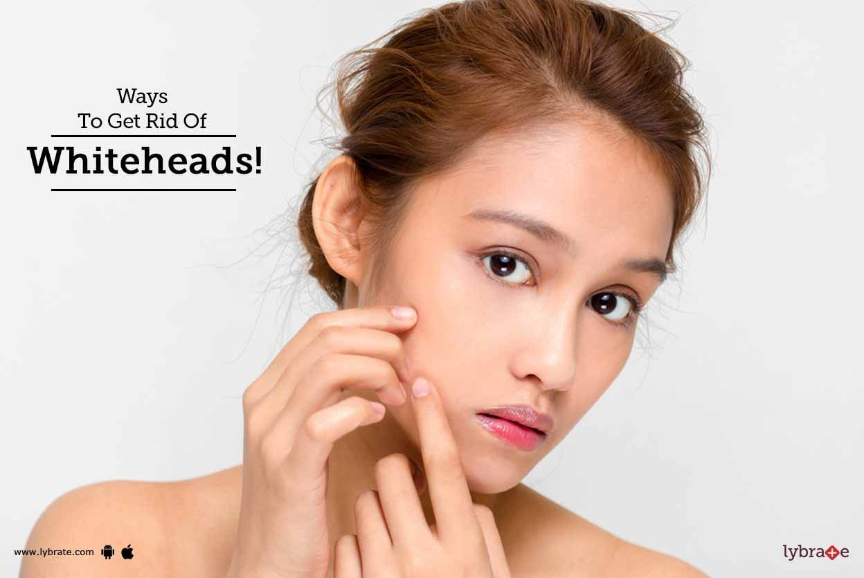 Ways To Get Rid Of Whiteheads!