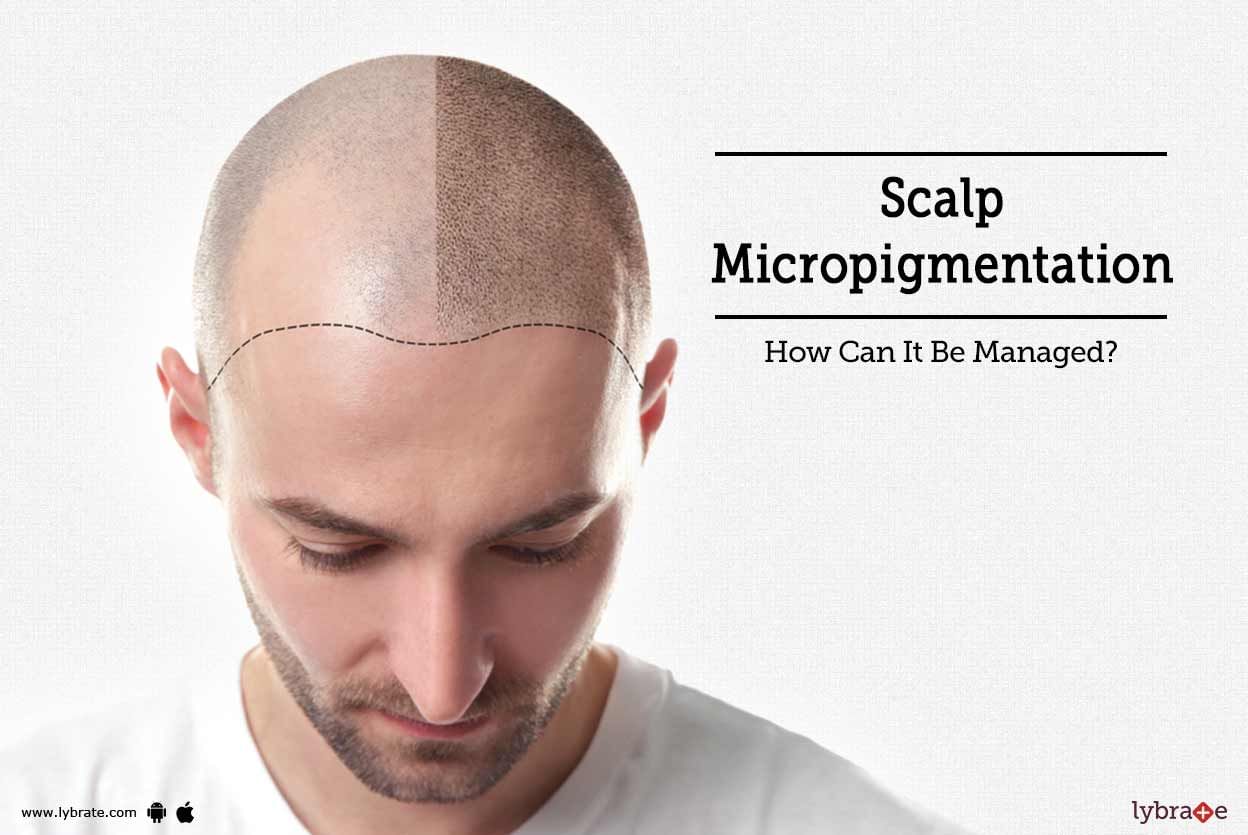 Scalp Micropigmentation - How Can It Be Managed?