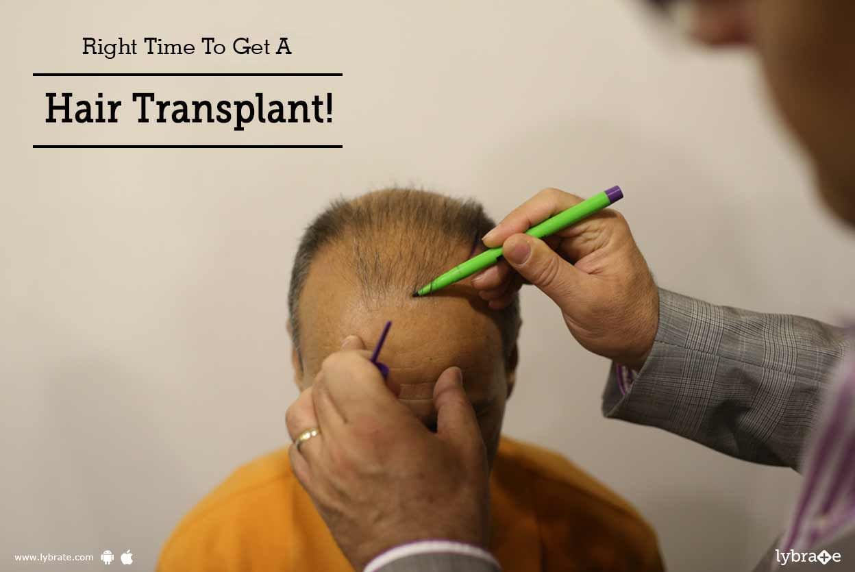 Right Time To Get A Hair Transplant!