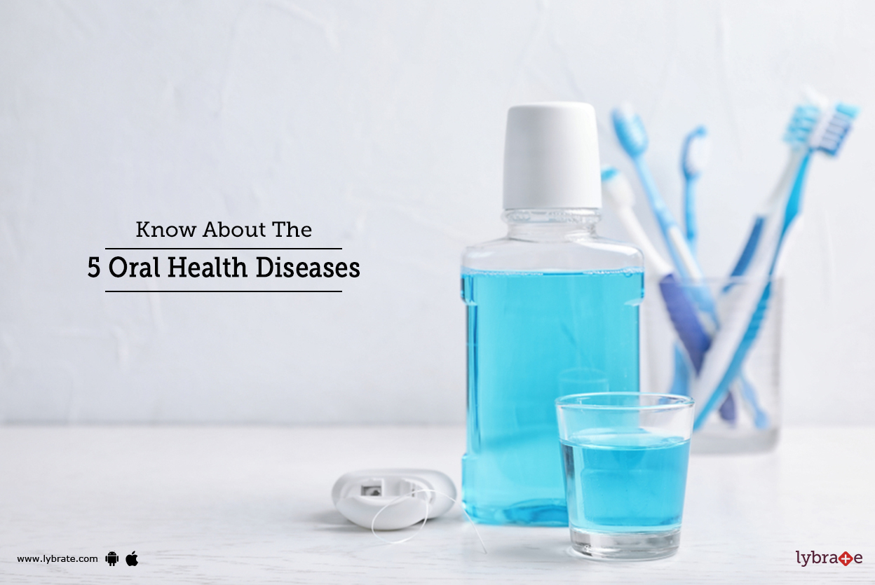 Know About The 5 Oral Health Diseases By Dr. Maj. Gen Mahesh Chander