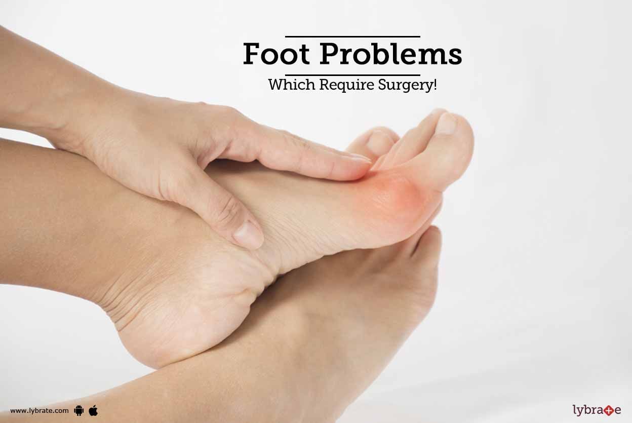 Foot Problems Which Require Surgery!