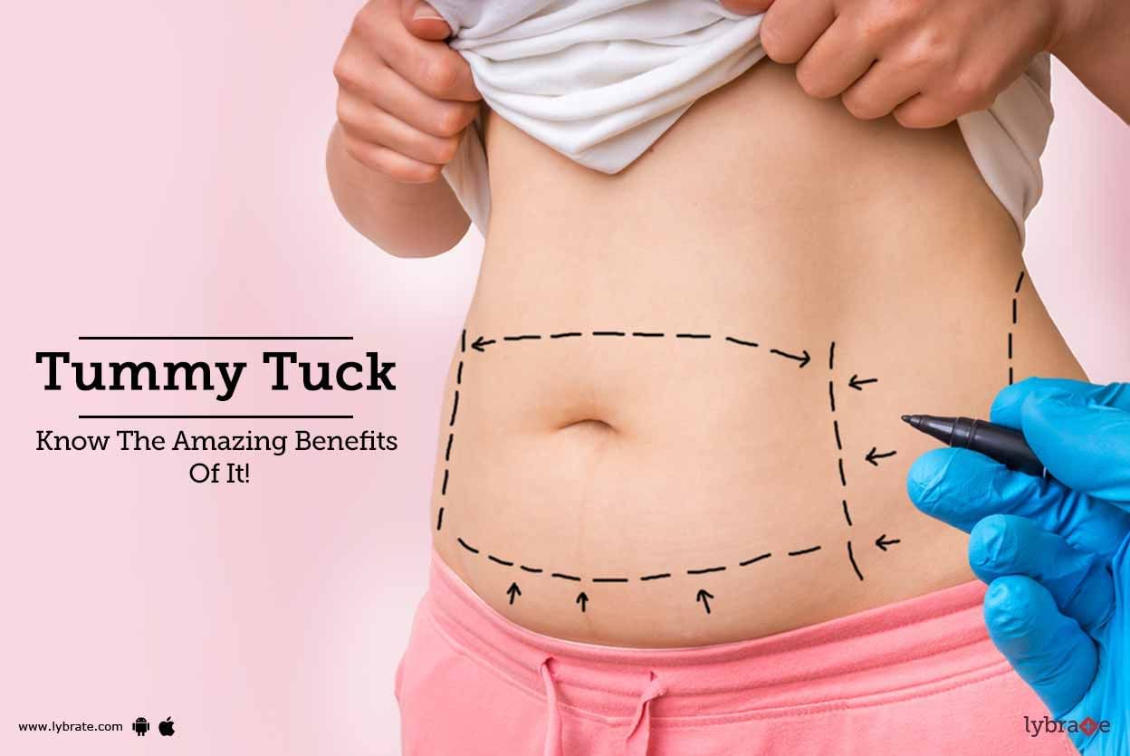 Tummy Tuck - Know The Amazing Benefits Of It!