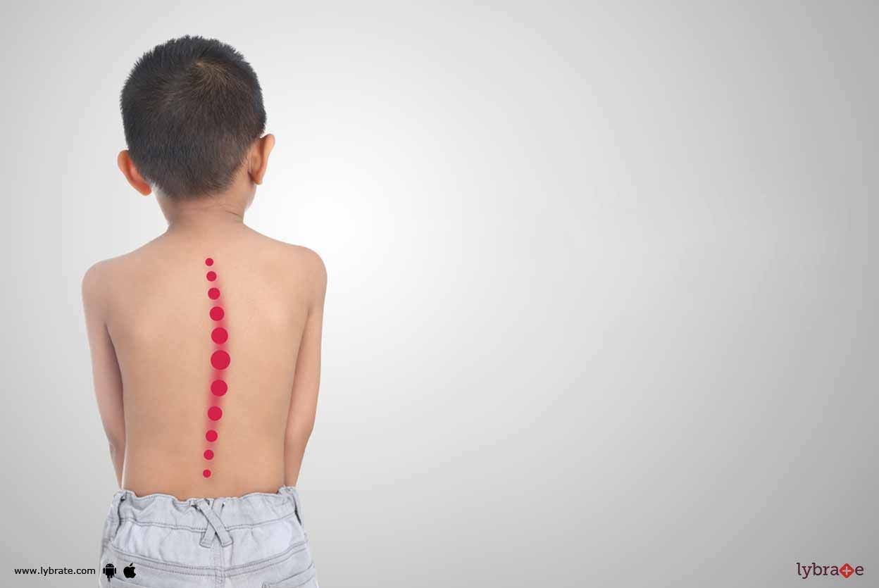 Common Orthopedic Disorders In Children - Learn More