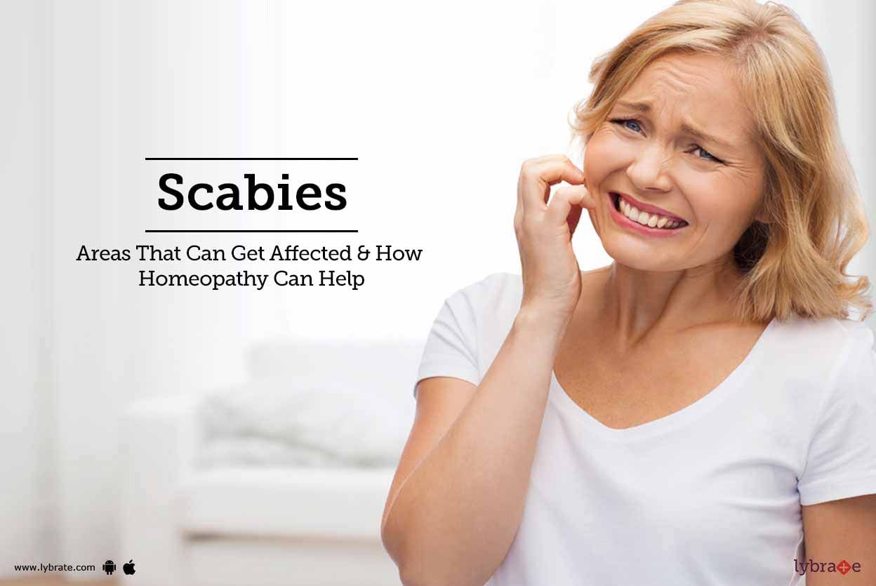 Scabies - Areas That Can Get Affected & How Homeopathy Can Help