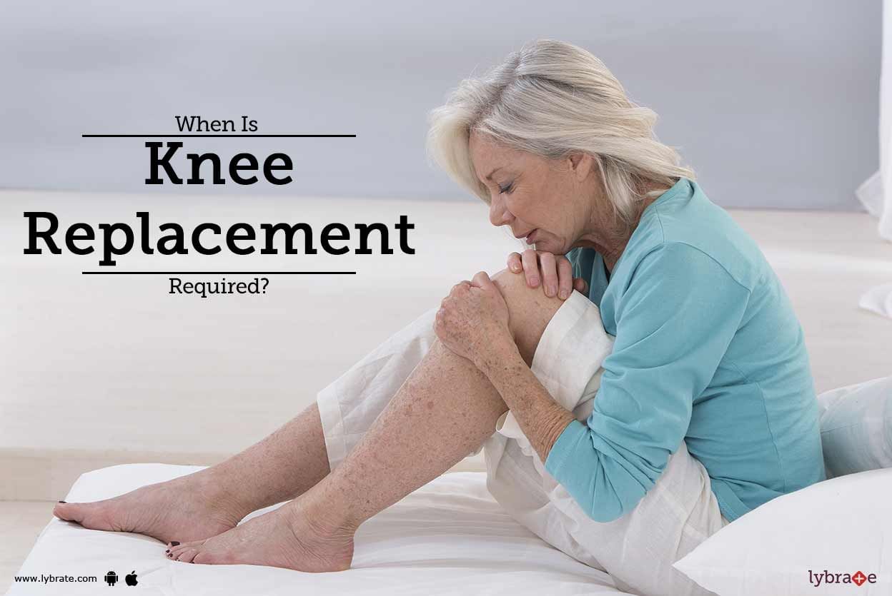 When Is Knee Replacement Required?
