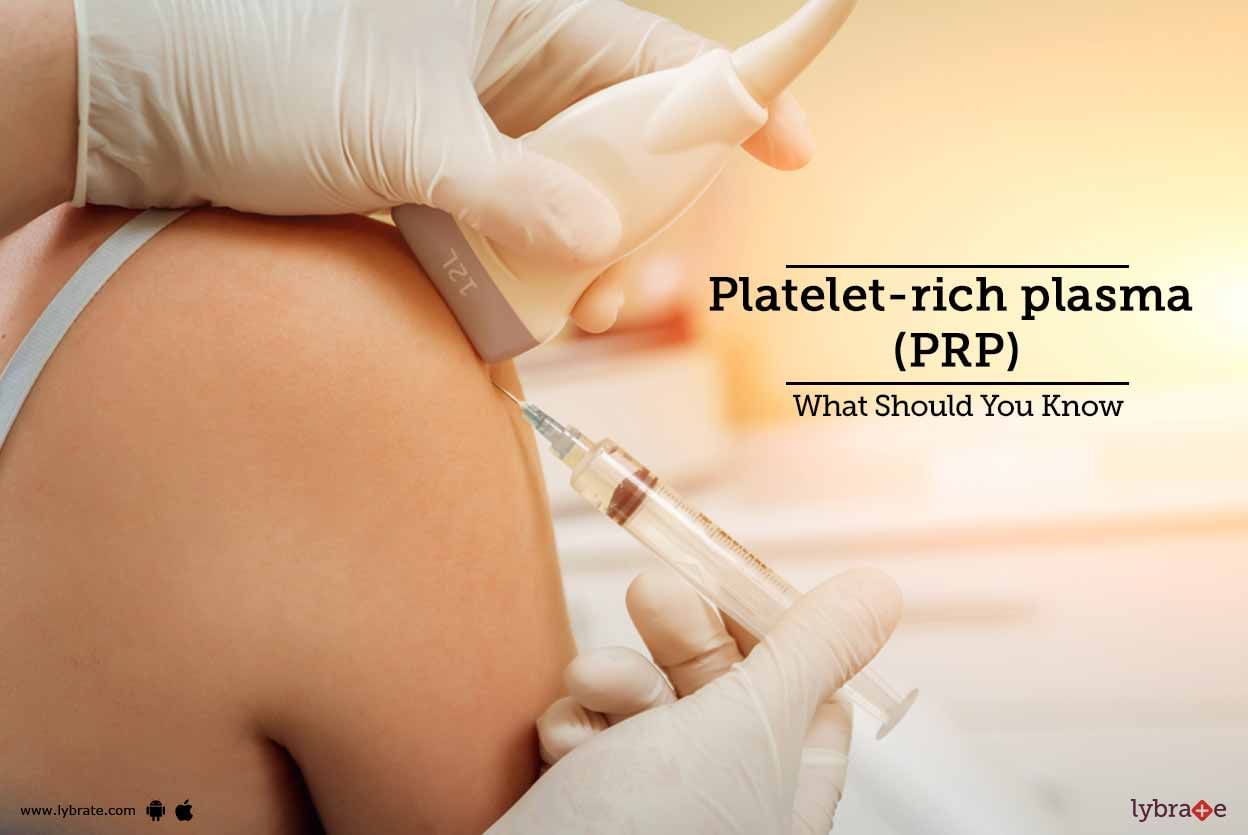 Platelet-rich plasma (PRP) - What Should You Know