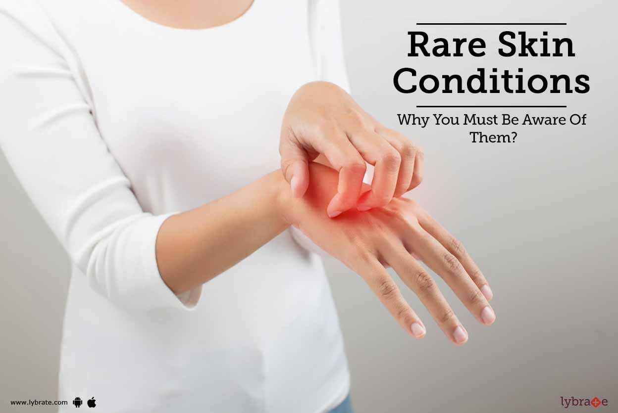 Rare Skin Conditions - Why You Must Be Aware Of Them?