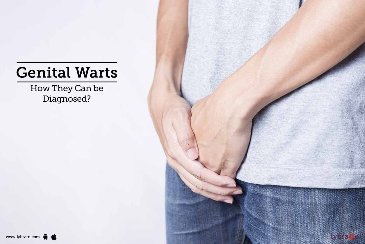 Genital Warts - How They Can be Diagnosed?