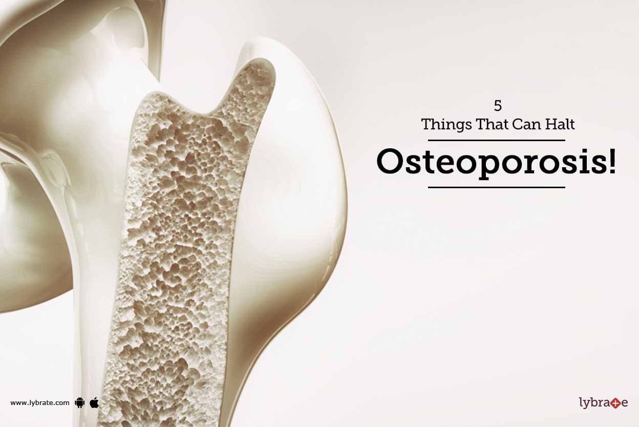 5 Things That Can Halt Osteoporosis!