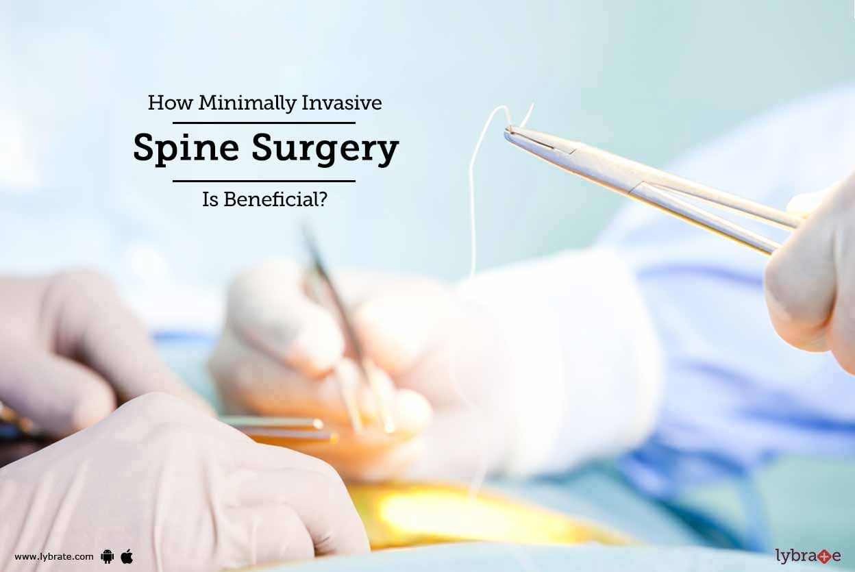How Minimally Invasive Spine Surgery Is Beneficial?