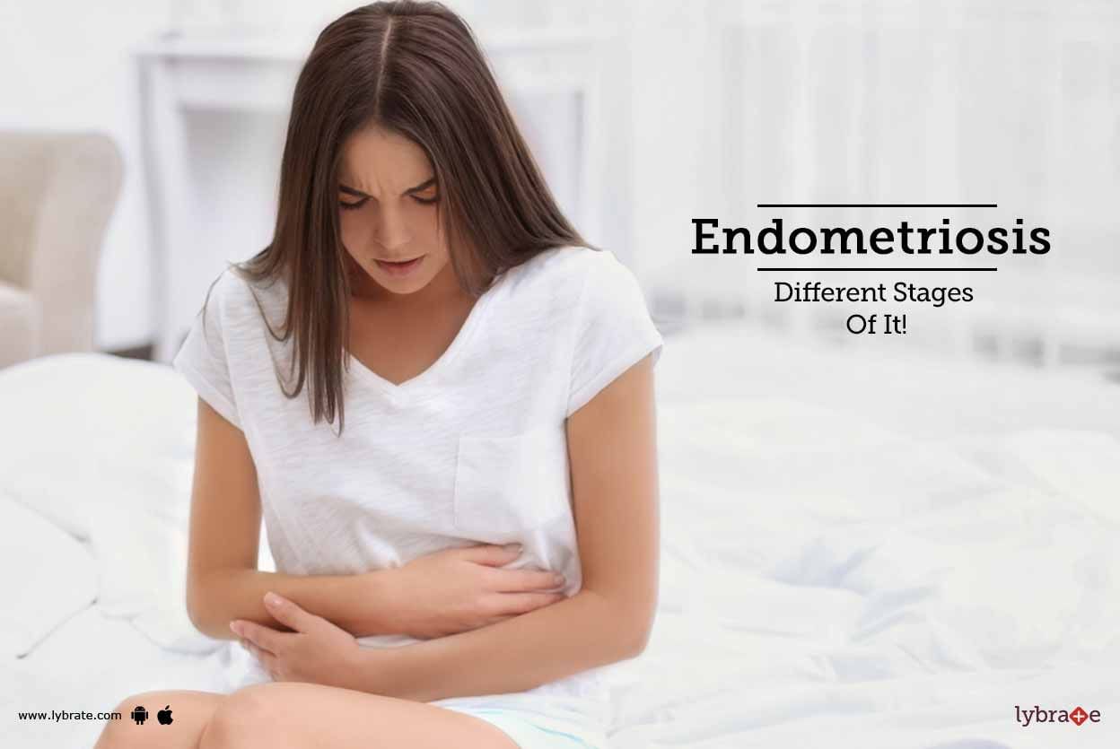 Endometriosis - Different Stages Of It!