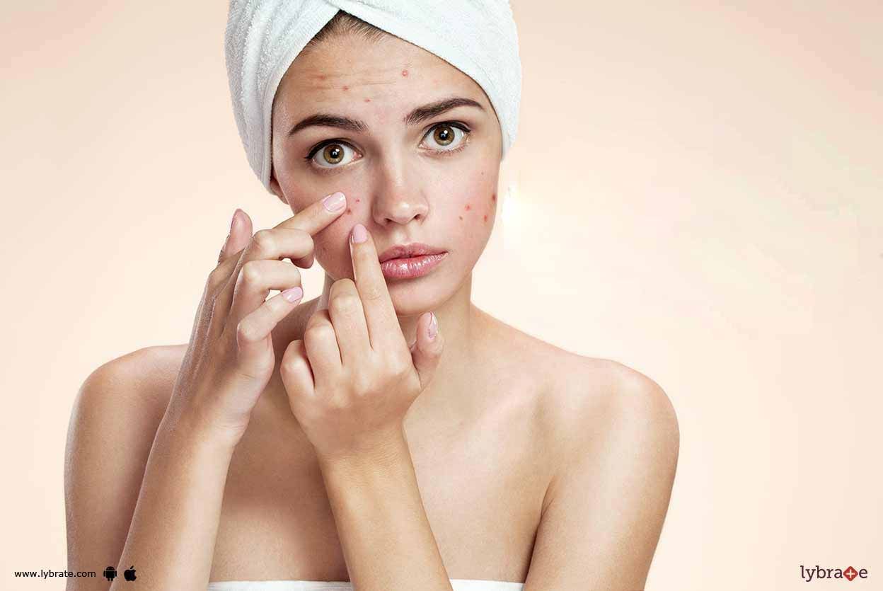 What Makes Your Skin Prone to Acne?