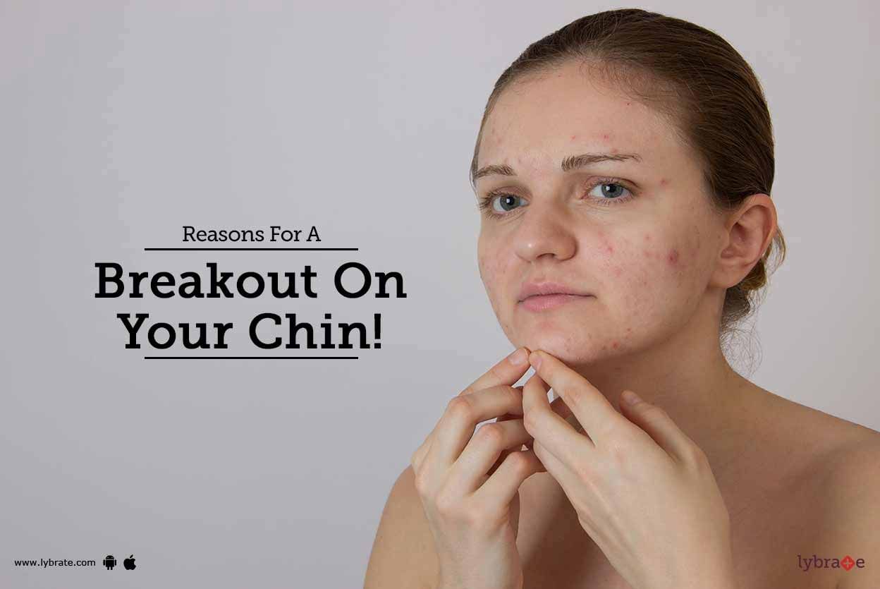 Reasons For A Breakout On Your Chin!
