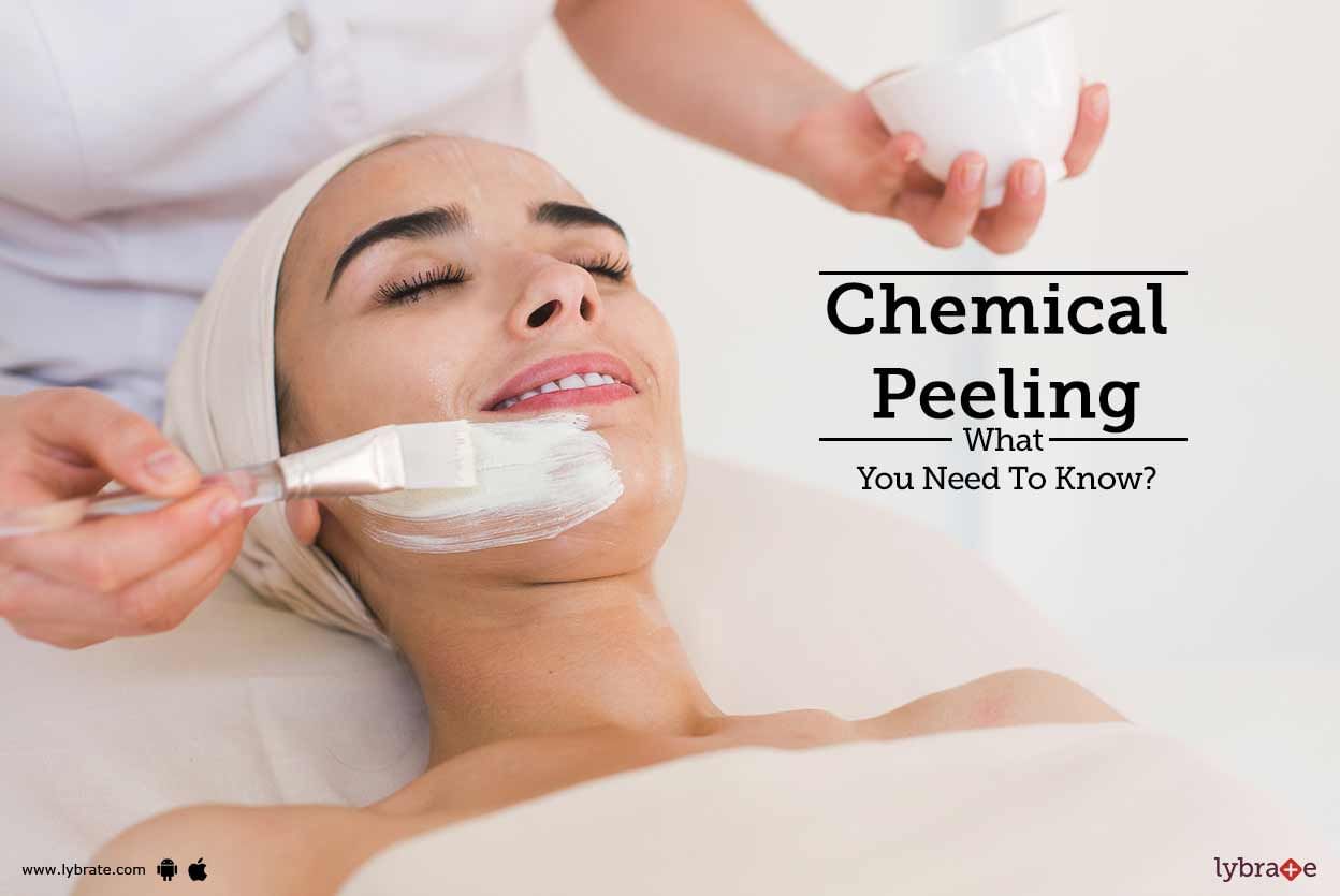 Chemical Peeling: What You Need To Know?