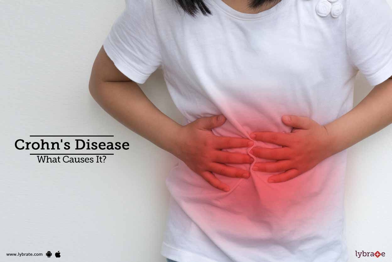 Crohn's Disease - What Causes It?