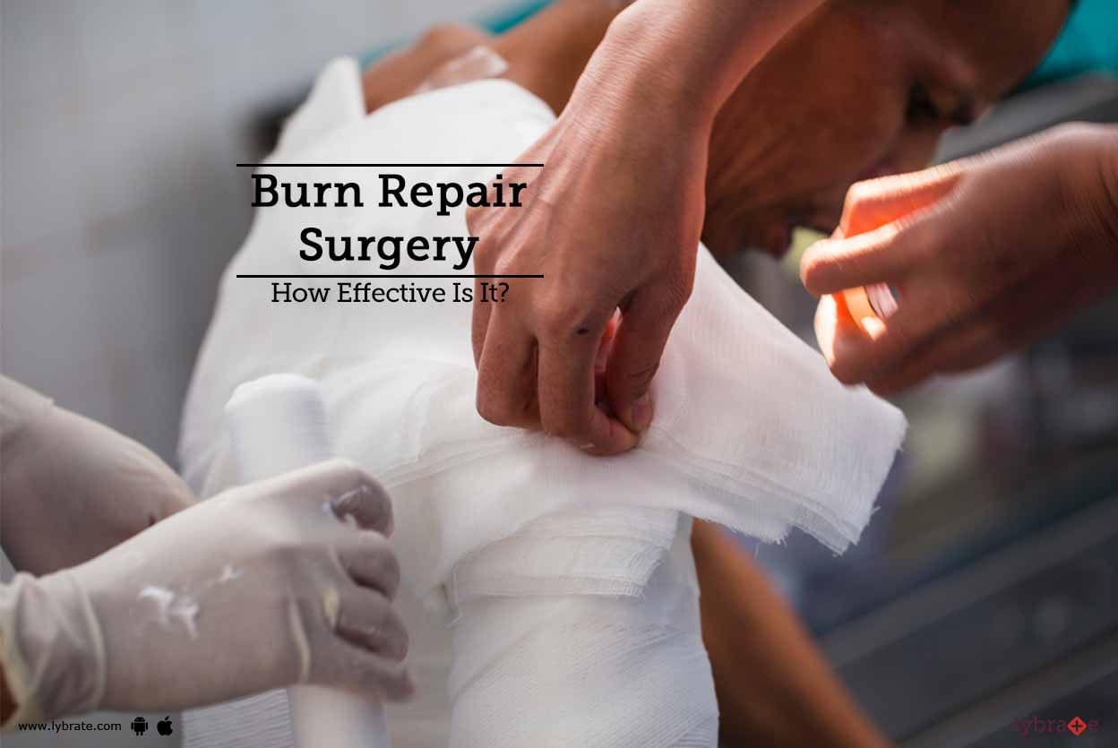 Burn Repair Surgery: How Effective Is It?