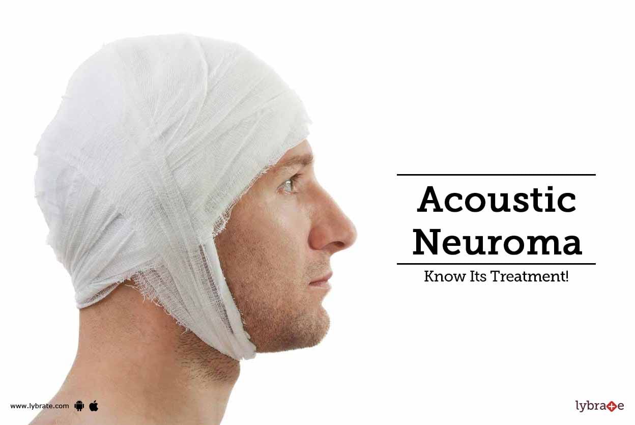 Acoustic Neuroma - Know Its Treatment!