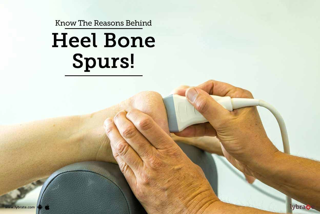 Know The Reasons Behind Heel Bone Spurs!