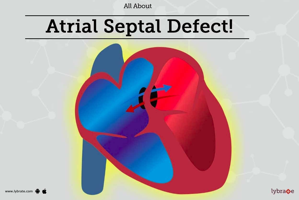 All About Atrial Septal Defect!