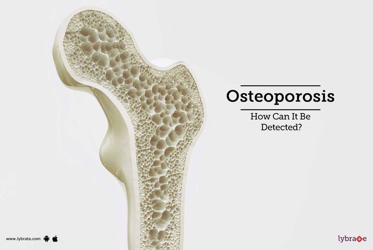 Osteoporosis - How Can It Be Detected?