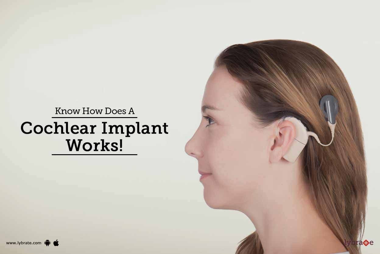 Know How Does A Cochlear Implant Works!