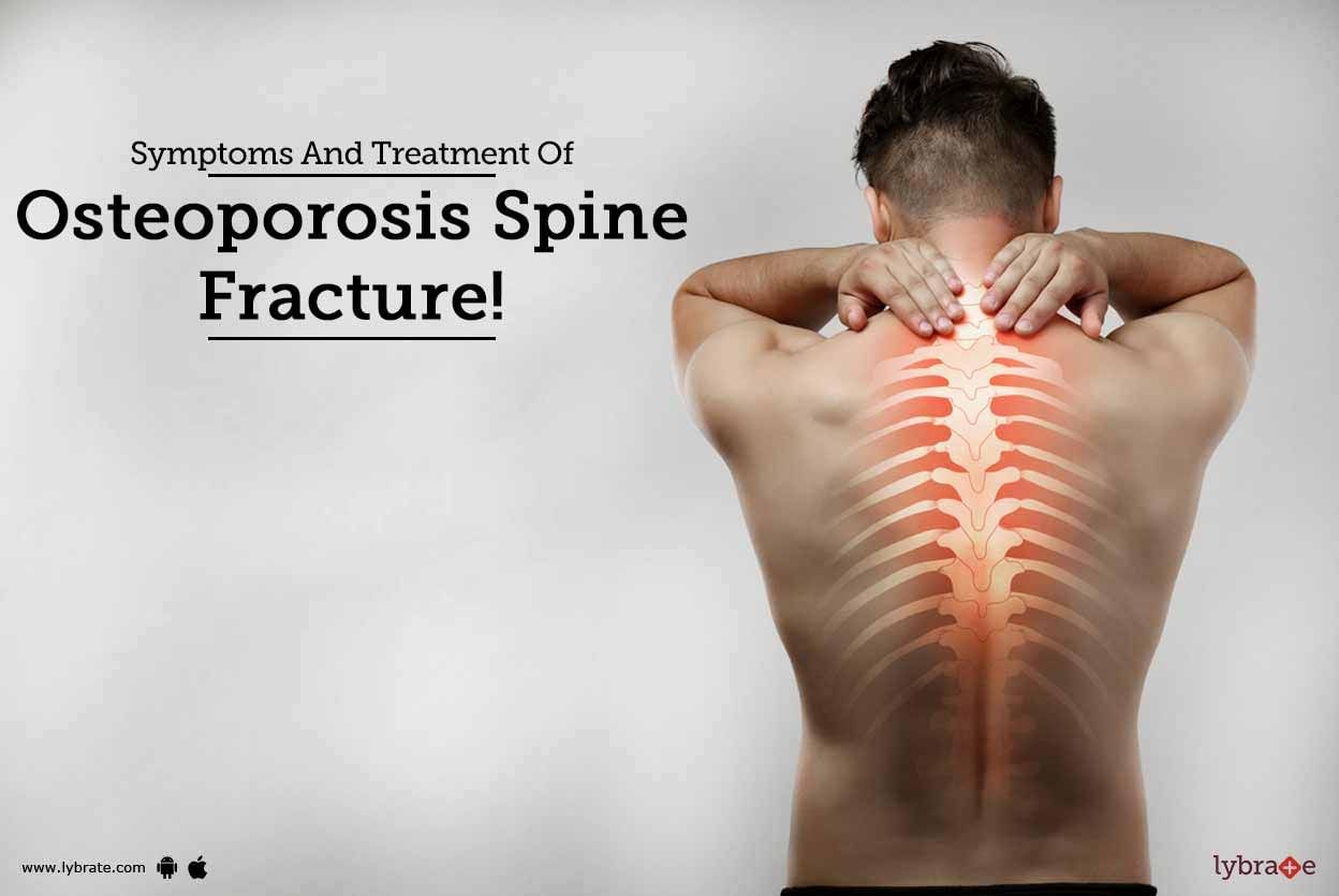 Symptoms And Treatment Of Osteoporosis Spine Fracture!