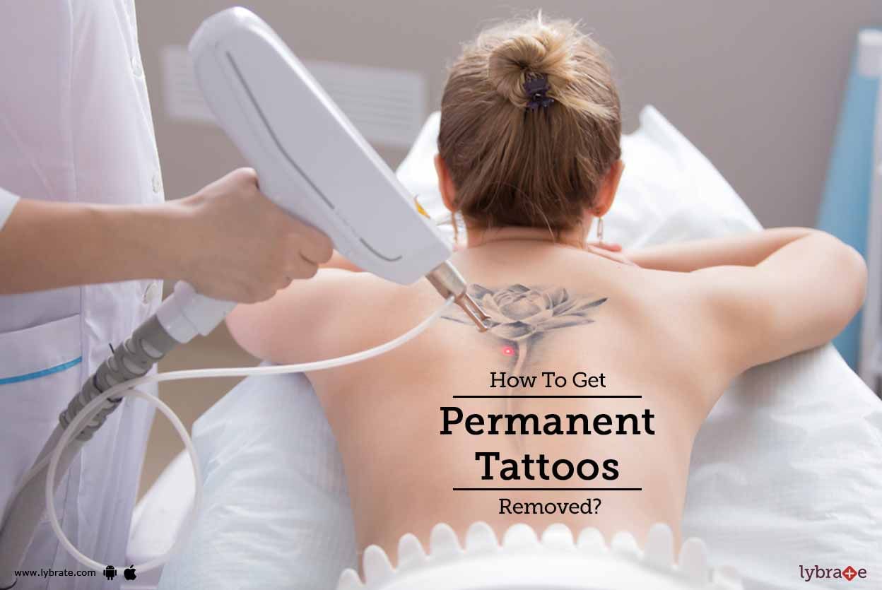 How To Get Permanent Tattoos Removed?