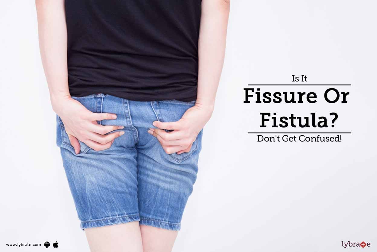 Is It Fissure Or Fistula? Don't Get Confused!