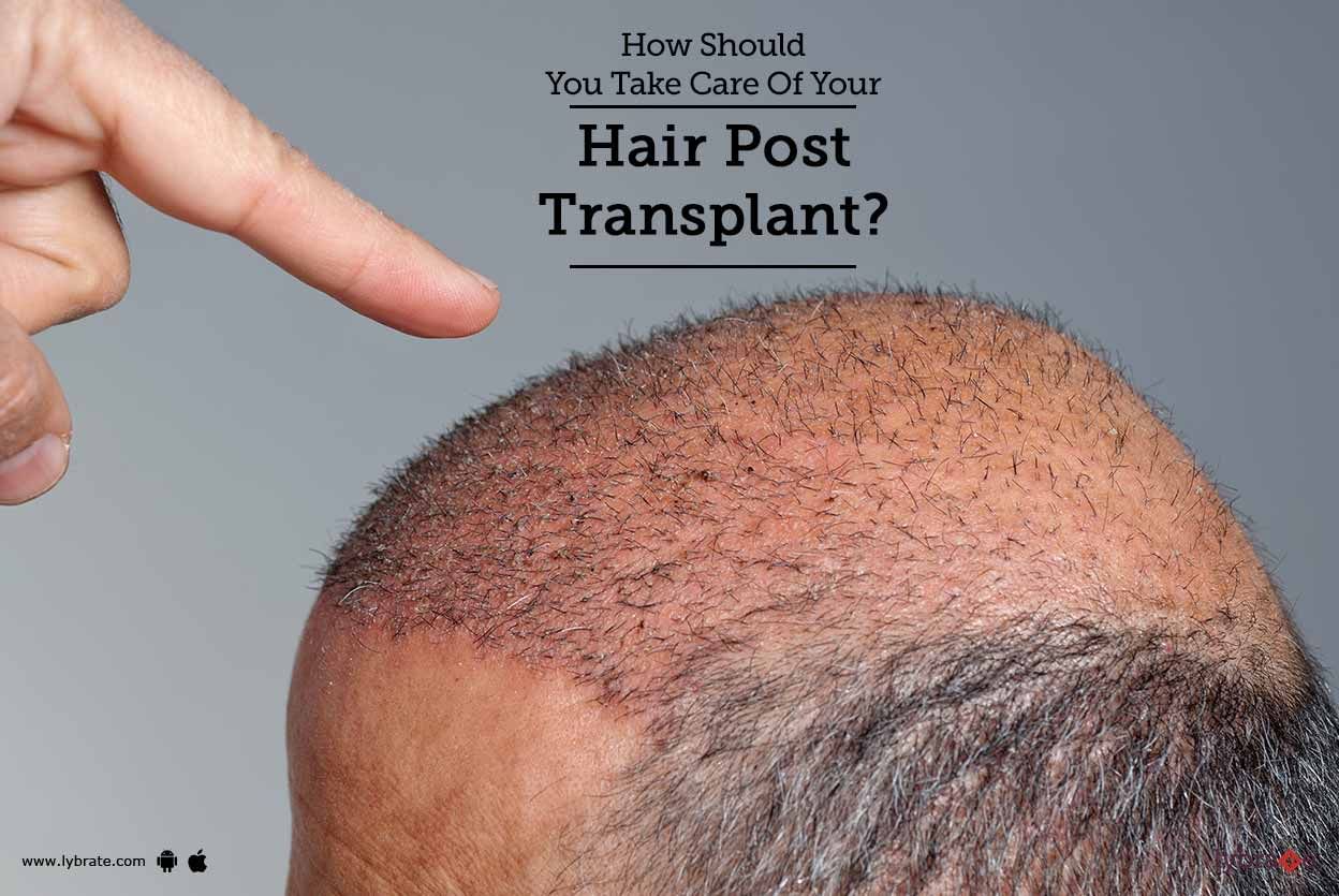 How Should You Take Care Of Your Hair Post Transplant?
