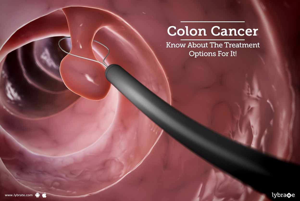 Colon Cancer - Know About The Treatment Options For It!