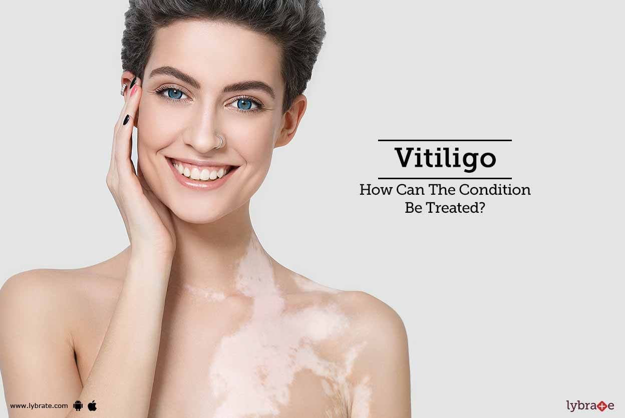 Vitiligo - How Can The Condition Be Treated?