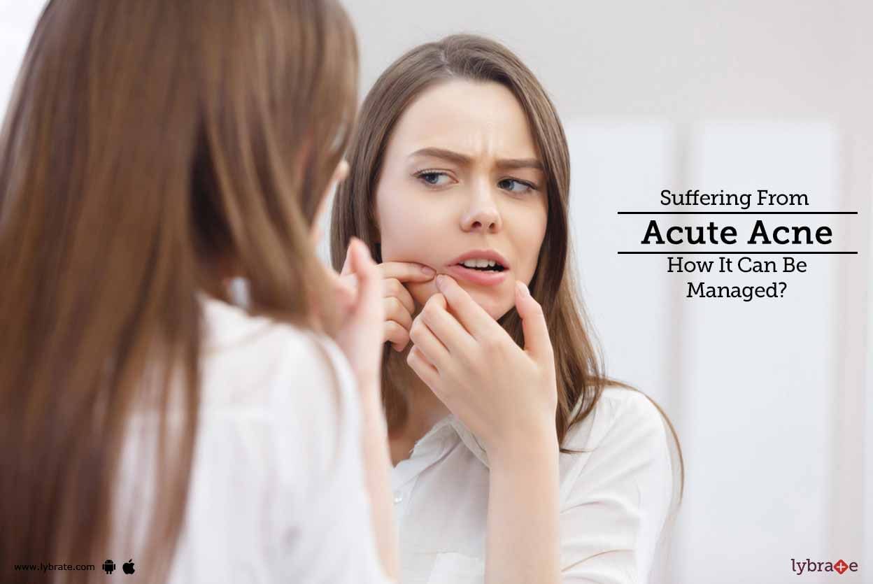 Suffering From Acute Acne - How It Can Be Managed?
