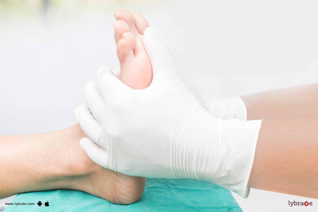 Diabetic Neuropathy - Everything You Should Know About It!