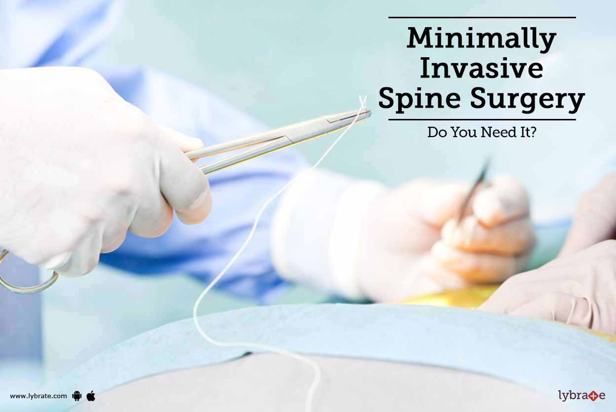 Minimally Invasive Spine Surgery - Do You Need It?