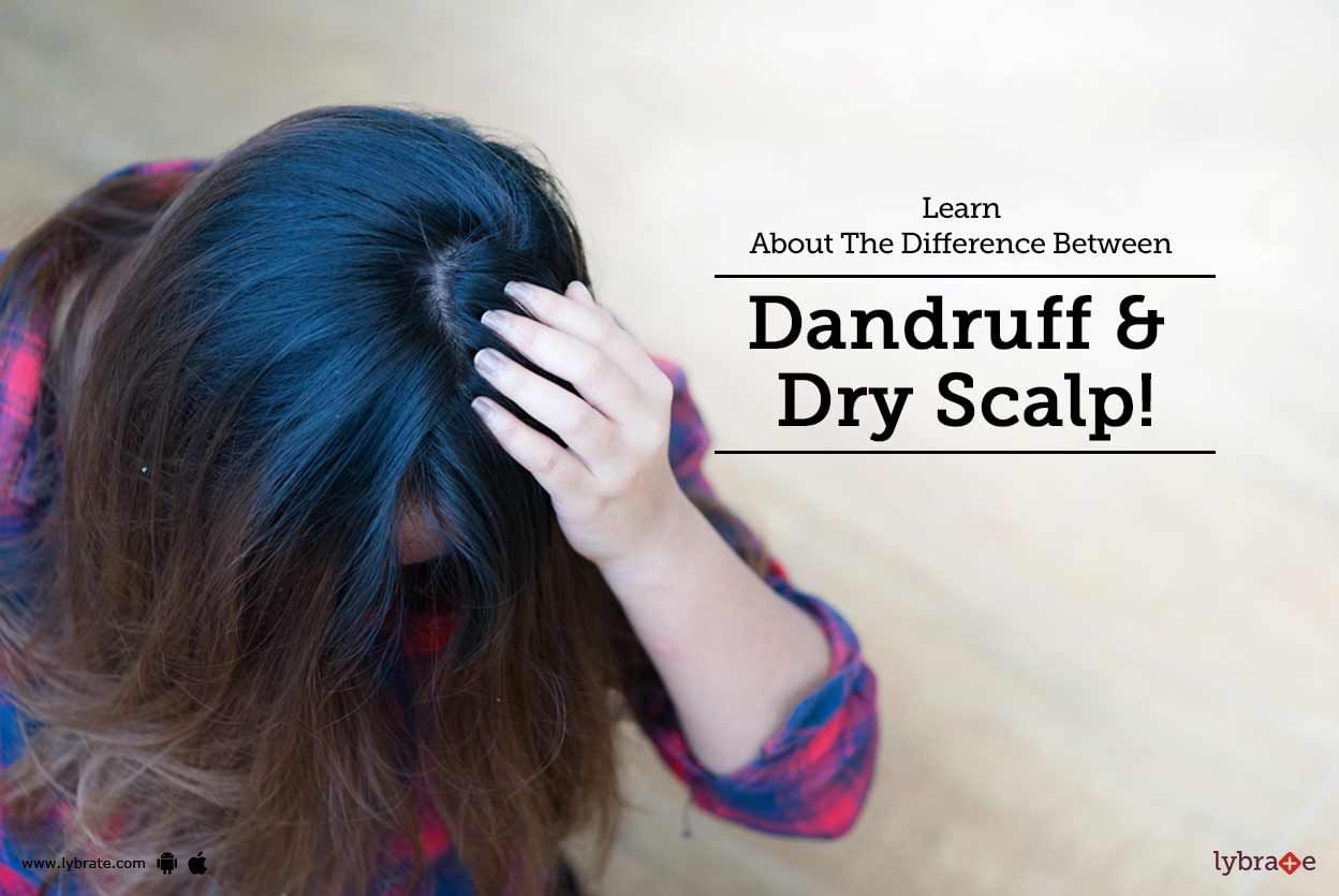 Learn About The Difference Between Dandruff & Dry Scalp!