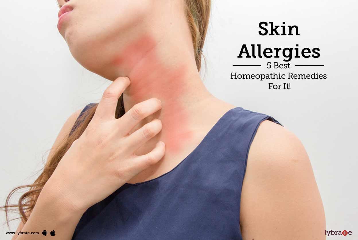 Skin Allergies - 5 Best Homeopathic Remedies For It!