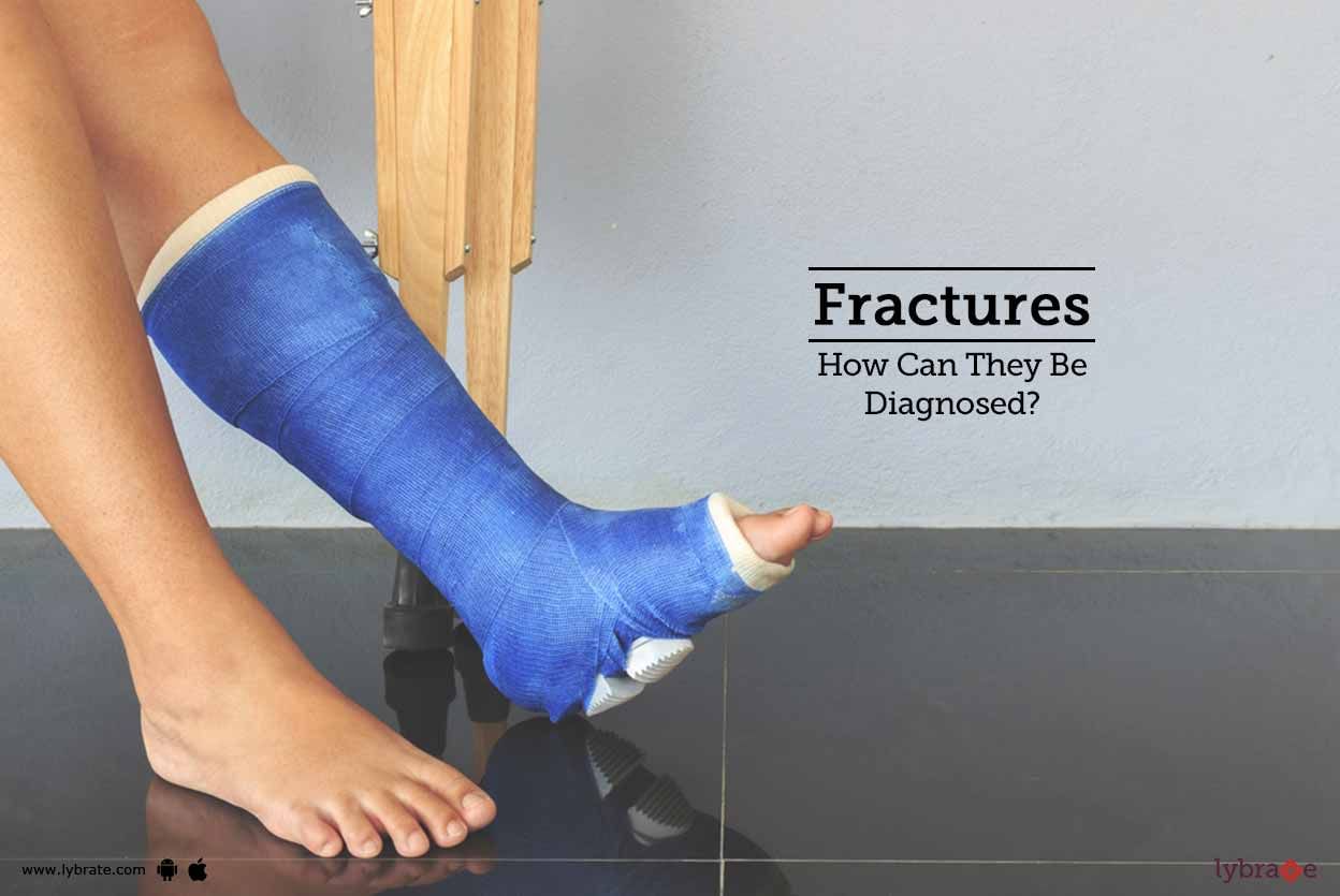 Fractures - How Can They Be Diagnosed?