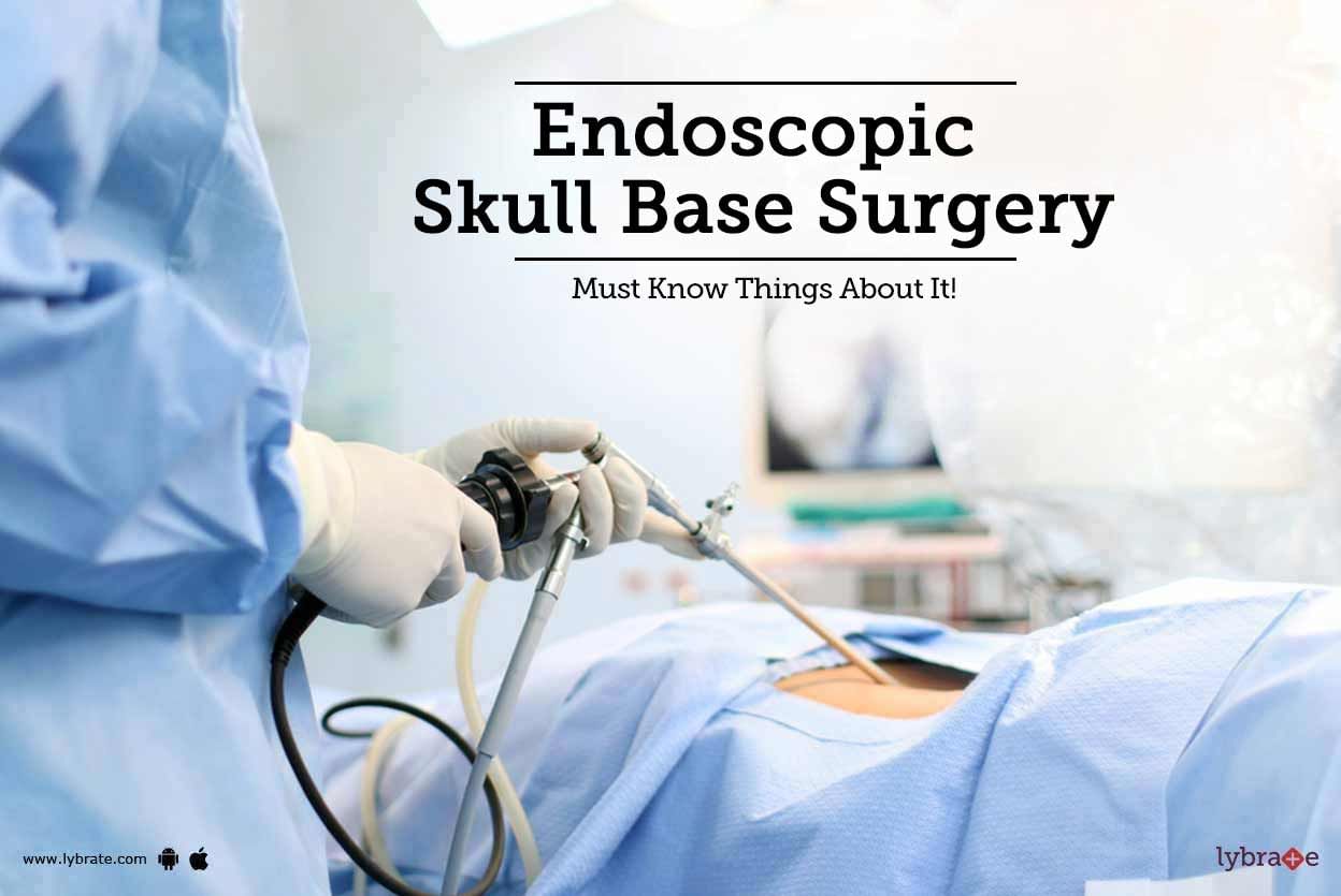 Endoscopic Skull Base Surgery - Must Know Things About It!