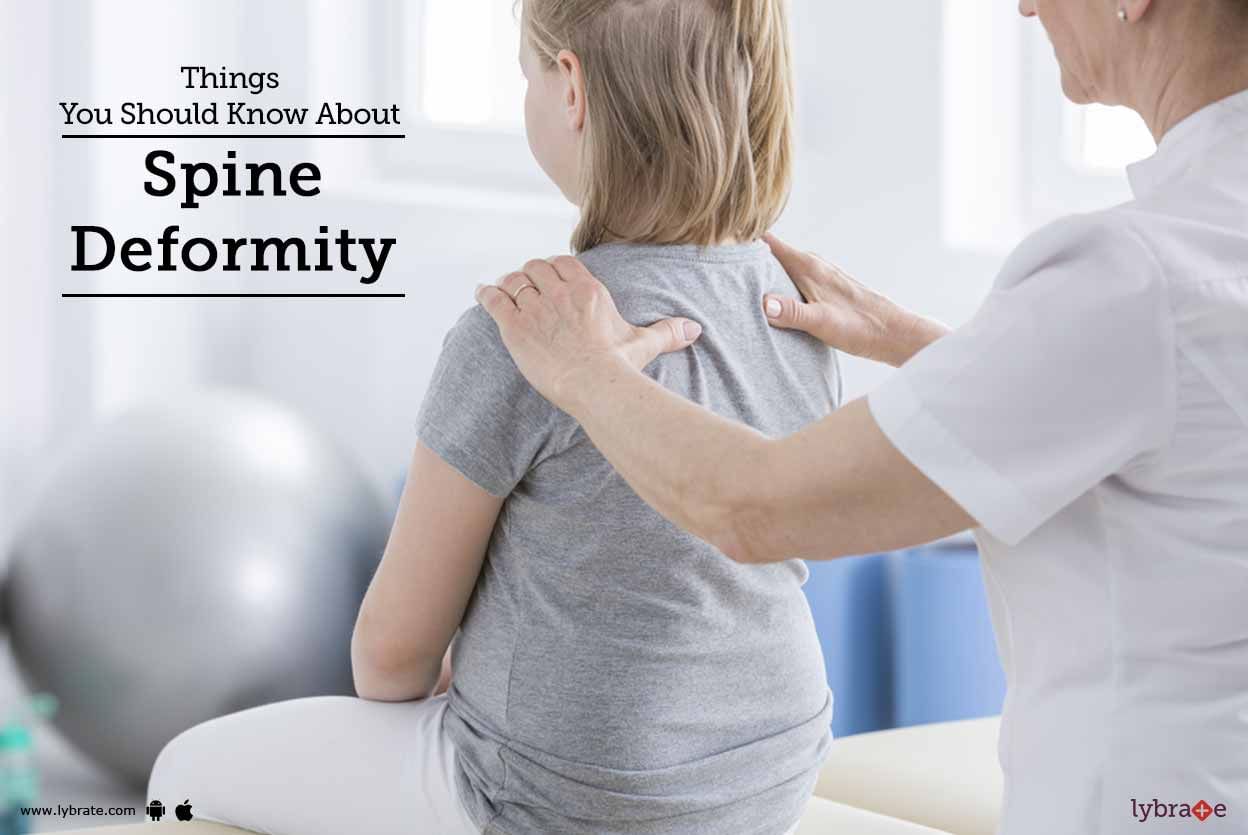 Things You Should Know About Spine Deformity