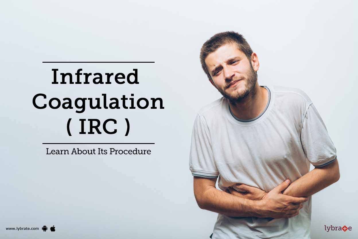 Infrared Coagulation ( IRC ) - Learn About Its Procedure