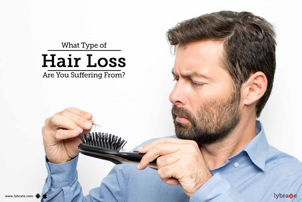 What Type of Hair Loss Are You Suffering From?