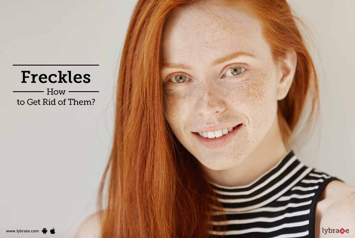 Freckles - How to Get Rid of Them?
