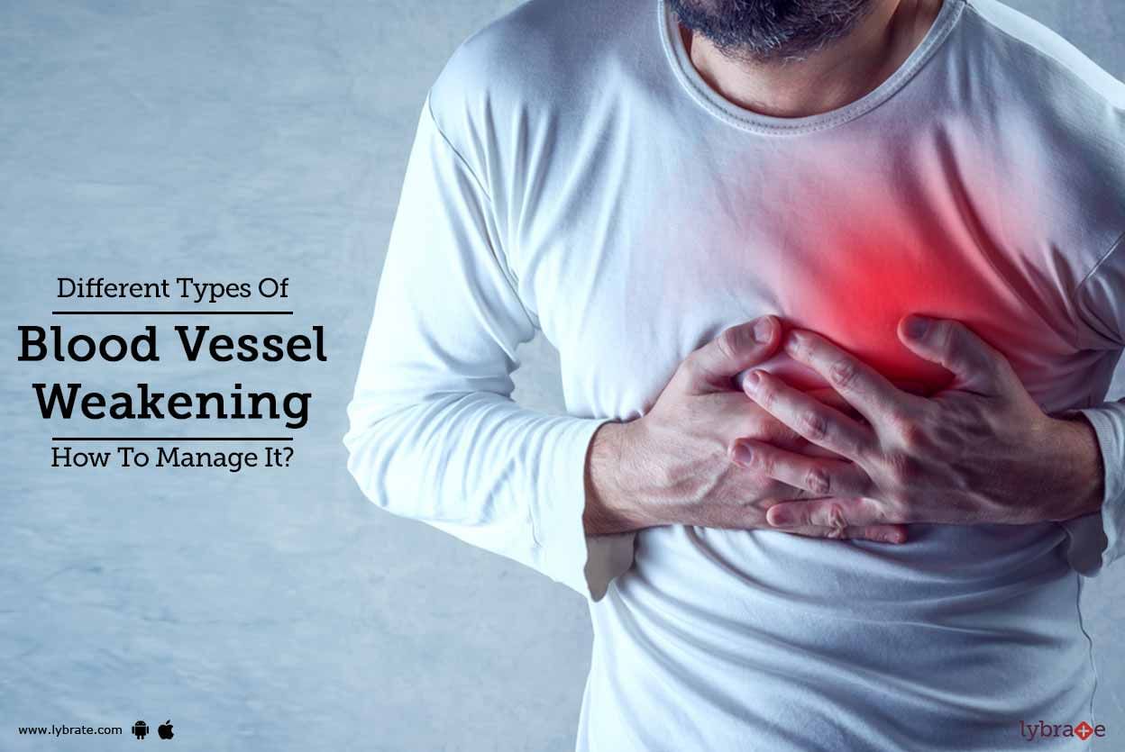 Different Types Of Blood Vessel Weakening - How To Manage It?