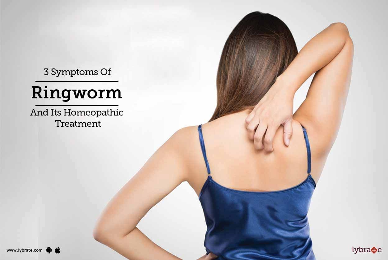 3 Symptoms Of Ringworm And Its Homeopathic Treatment