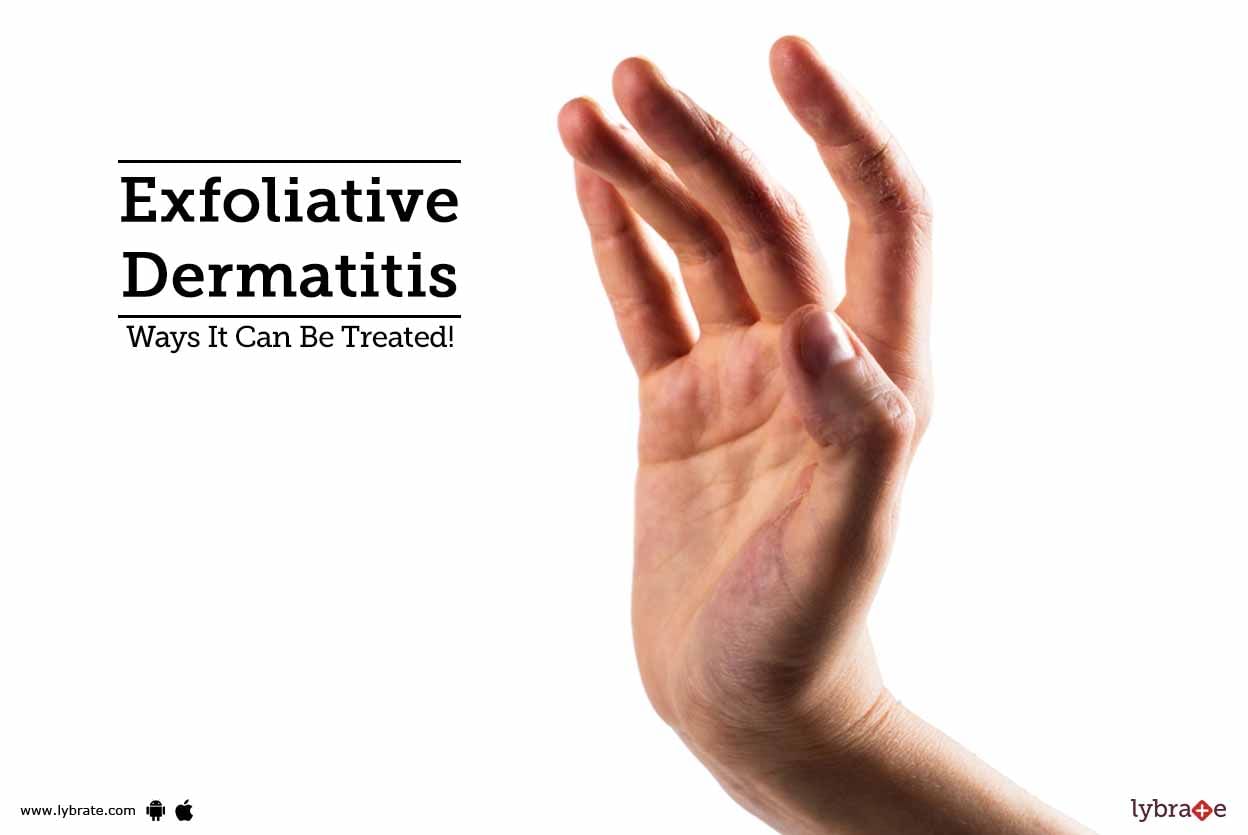 Exfoliative Dermatitis - Ways It Can Be Treated!