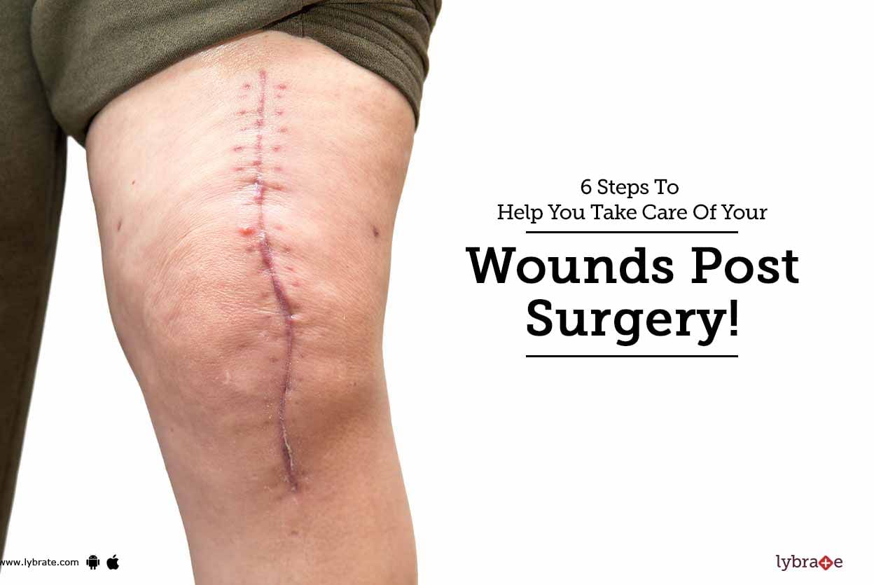 6 Steps To Help You Take Care Of Your Wounds Post Surgery!